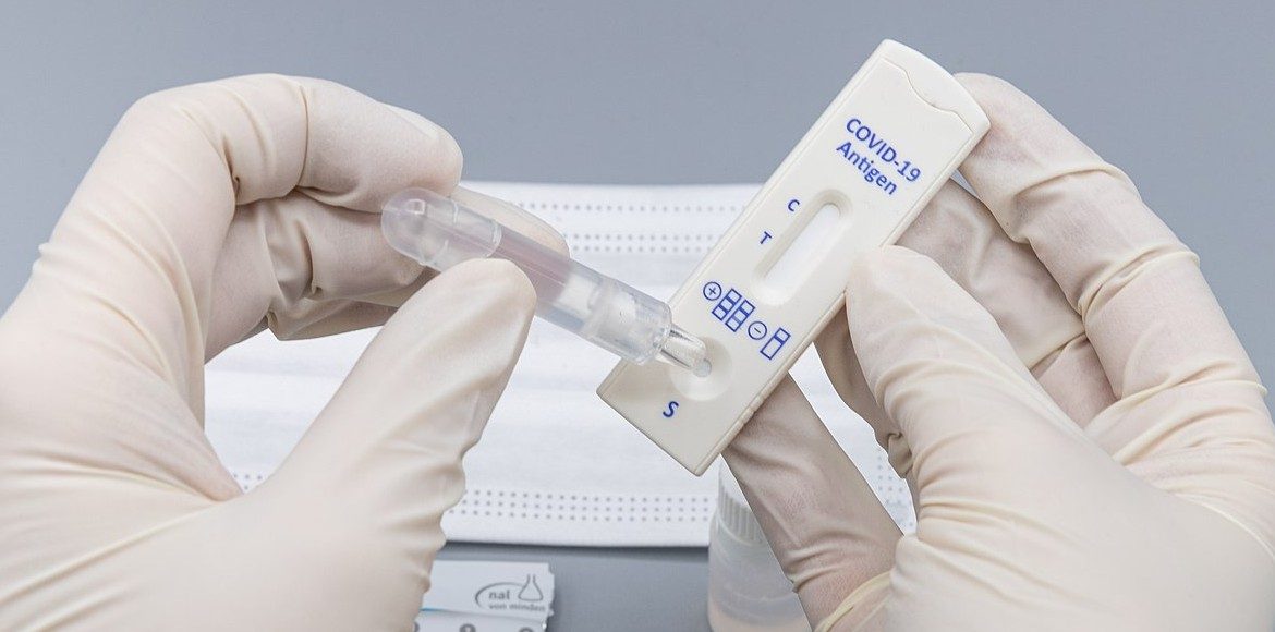 Rapid Antigen Test for COVID-19 (RAT test)